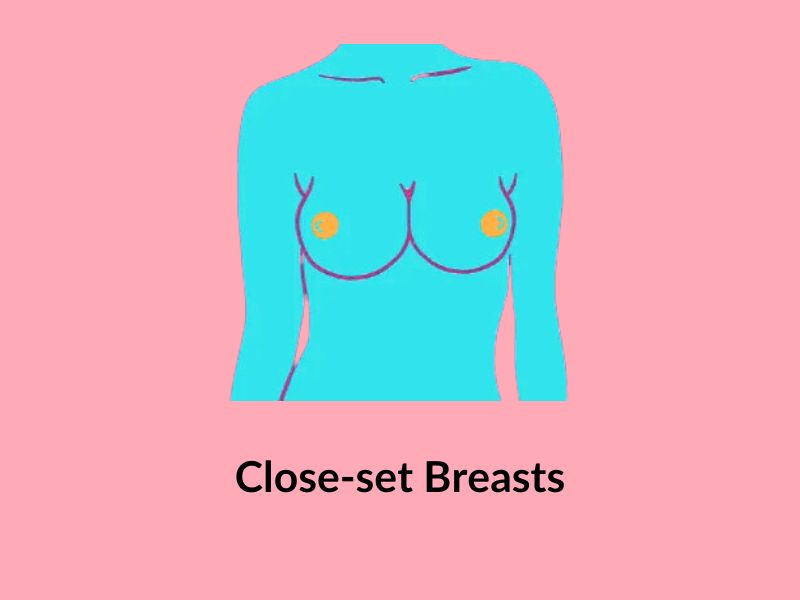 Close set breasts Close set breasts