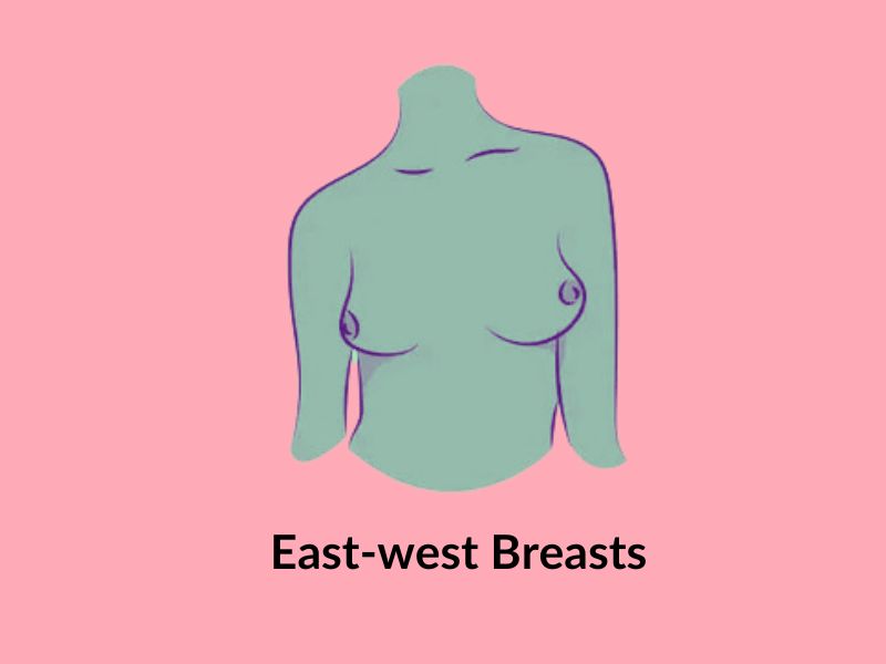 East west breasts East west breasts