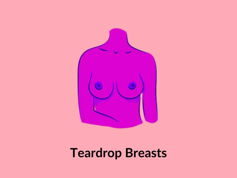 Teardrop breasts Teardrop breasts