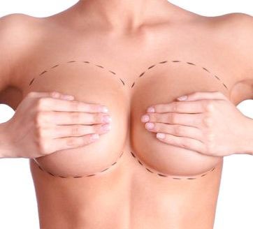 Breast-Aesthetic-Antalya