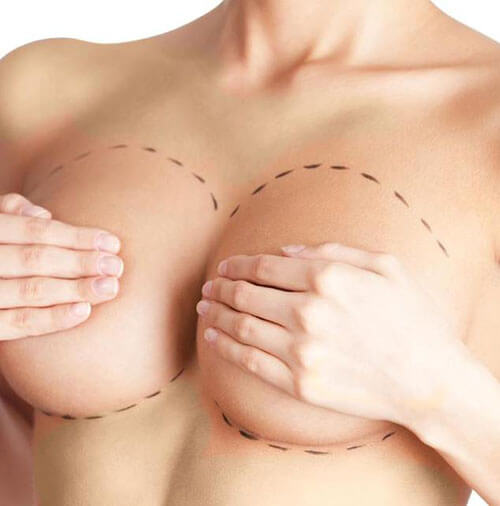 breast-augmentation-Antalya