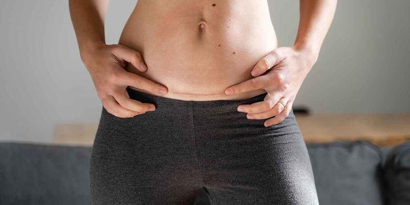 abdominoplasti-riskli-mi