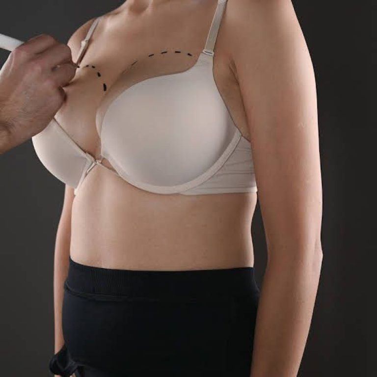 Doctor drawing marks on female breast before cosmetic surgery operation.