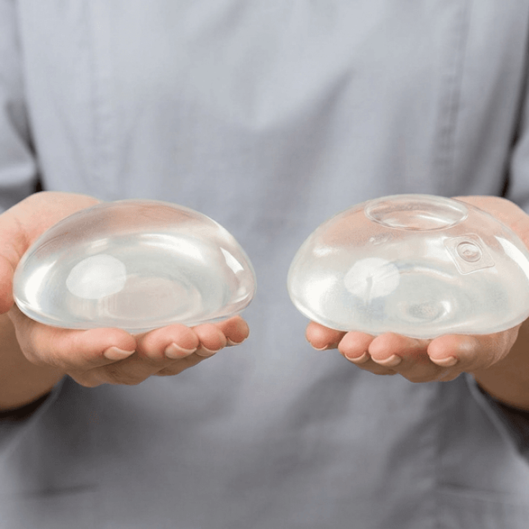 Profesyonel, klinik bir editöryal fotoğraf, açık gri bir tıbbi scrub üstü giyen bir kişinin avuçlarında tutulan iki meme implantını yakalıyor. 85mm makro lensle çekilen görüntü, 8k çözünürlükte keskin, hiper gerçekçi bir kaliteye sahip. Yumuşak, dağılmış stüdyo ışığı, tıbbi dereceli silikon implantların yarı saydam, jel benzeri dokusunu ve pürüzsüz, konturlu yüzeylerini vurguluyor. Odak, nesnelerin yapısal tasarımını ve iç detaylarını, iki implant arasındaki şekil farklılıklarını da vurgulayacak şekilde sıkıca kilitlenmiştir. Arka plan, steril, güvenilir ve modern bir tıbbi ortamı yansıtan temiz, nötr, açık gri bir arka plana sahiptir. Kompozisyon dengeli ve merkezlenmiştir, cerrahi protezlerin yüksek kaliteli malzemelerini ve işçiliğini sergilemek için netlik ve teknik hassasiyeti ön planda tutar.